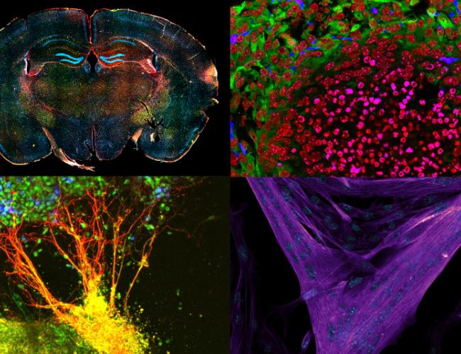 a collage of four microscopy images