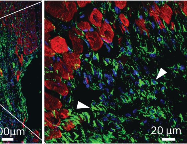 Microscopy image: Cardiac muscle shown in red and ENPP1 in green demonstrates expression of ENPP1 in the region of scar formation.