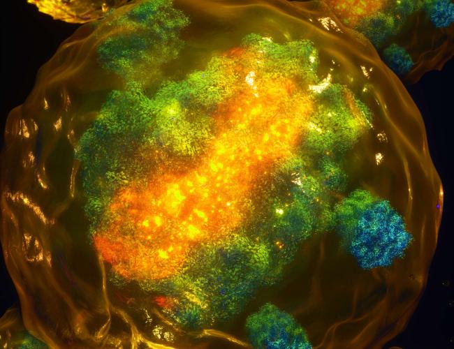 An artistic representation of the newly discovered trans-action by XIST, showing the X chromosome (yellow) and the extended and dispersed distribution of XIST (green) across the X chromosome and beyond, i.e. to autosomes, as seen with microscopy.