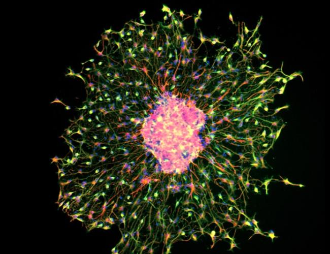 Image showing neural differentiation (with MAP2 protein in green and GFAP protein in red) in a neurosphere derived from mouse neural stem and progenitor cells.