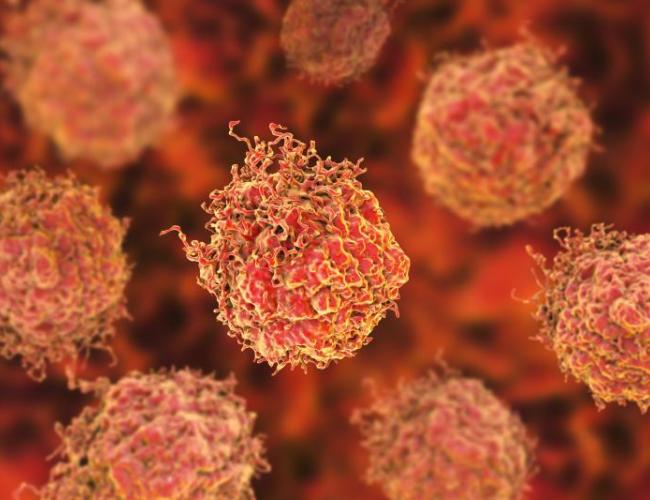 Prostate cancer cells
