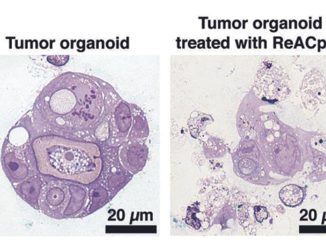 A side-by-side comparison of a tumor organoid before and after treatment. 