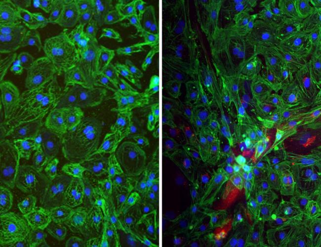 Microscopy images of human stem cell–derived mini-heart organoids. Left: healthy beating heart cells. Right: organoid tissue infected with Andes hantavirus (red), showing disrupted structure and loss of heartbeat.