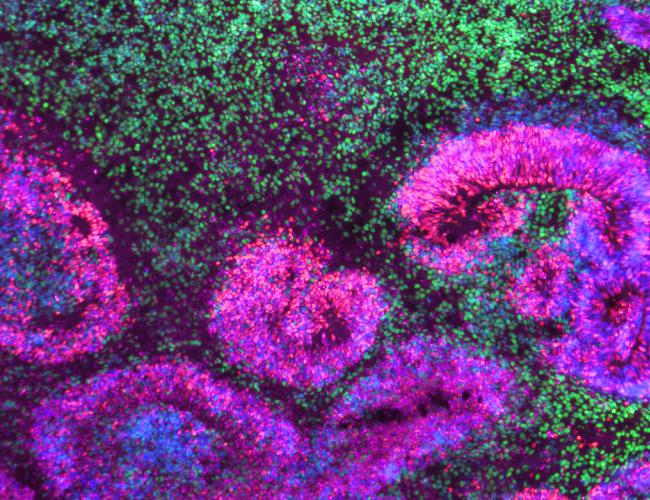 Microscopy image of a cortical organoid, a stem cell-derived model that mimics the developing human brain. The circular rosettes are clusters of neural stem cells giving rise to neurons, shown in green.
