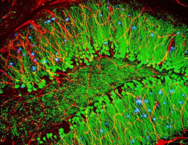 Mouse brain showing hallmarks of Alzheimer’s disease (plaques in blue)