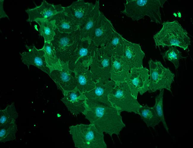 Blood-brain barrier cells stained in a fluorescent green