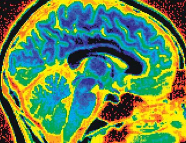 A colorful brain scan showing a side view with glowing hues of blue, green, yellow and red.