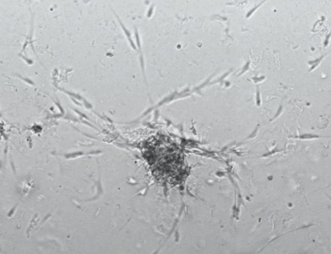 A microscopy image of cutaneous neurofibroma organoids