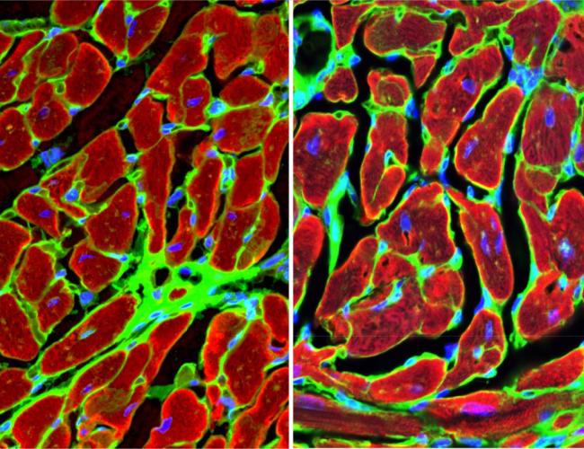 Microscopy image: Heart muscle cells surrounding the damaged tissue after a heart attack.
