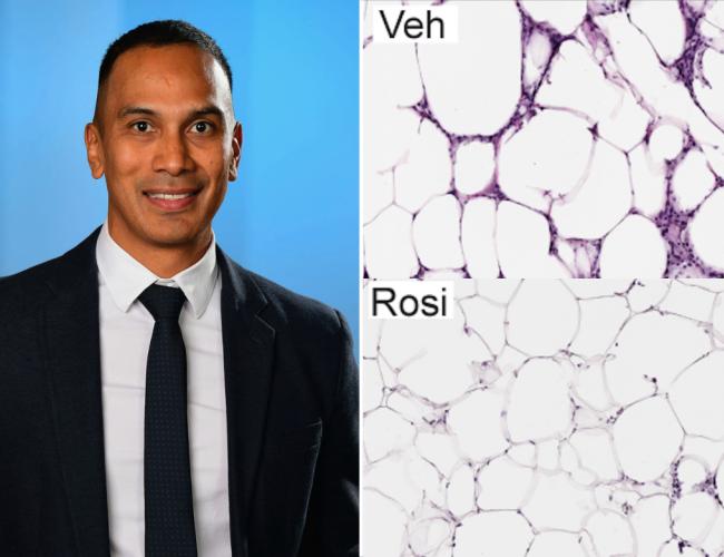 A collage: Clockwise from top right: Fat cells in obese, diabetic mice are larger than those in lean mice; when given rosiglitazone, fat stem cells in mice could produce smaller fat cells; Claudio Villanueva. 