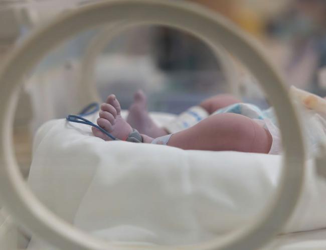 stock photo showing the legs of a newborn in a NICU with blue wires around the feet