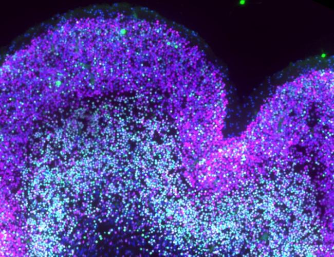 Developing neocortex in Down syndrome. IT neurons are labeled in magenta and deep-layer neurons in green. IT and double-positive neurons are increased in DS at this stage. 
