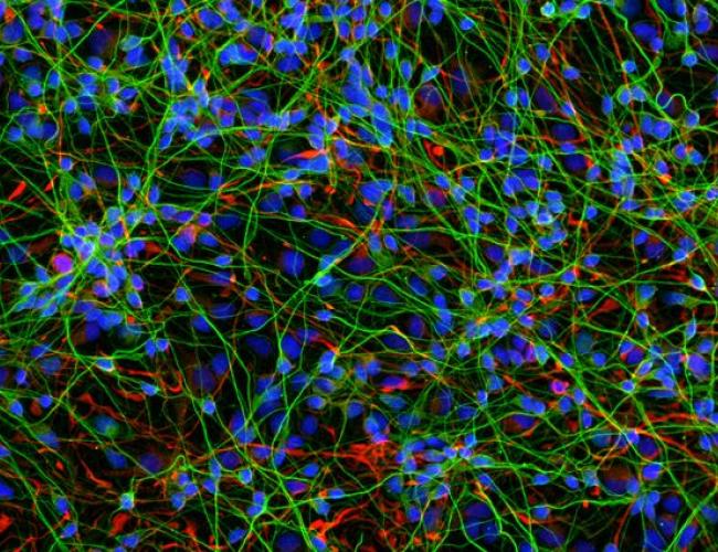 Microscopy image of cultured differentiated human neural progenitors