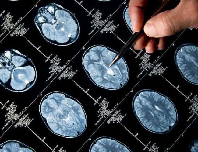 Brain scan images with a hand gesturing.