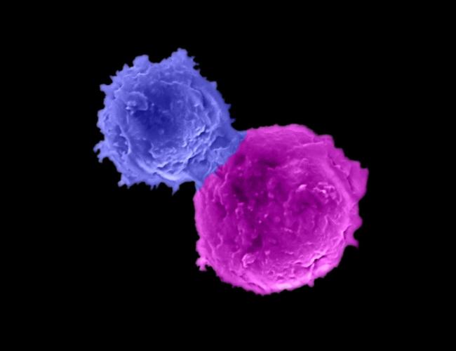 CAR-NKT cell in blue attacking a human multiple myeloma cell in magenta