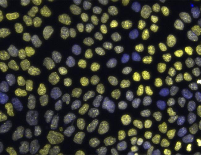 An image showing epithelial chromatin variation, with DNA (blue) and histone marker H3K27me3 (yellow) that represses gene activity