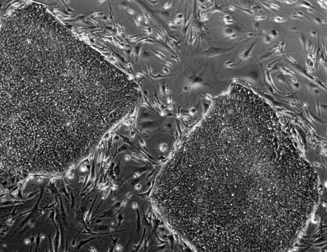 Microscopy image of iPSCs.