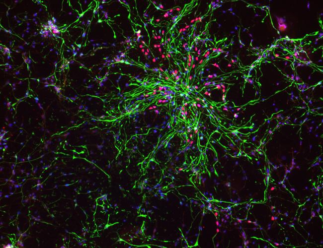 Fluorescence microscopy image showing a dense network of branching astrocytes in green, interspersed with red intermediate progenitor cells against a dark background.