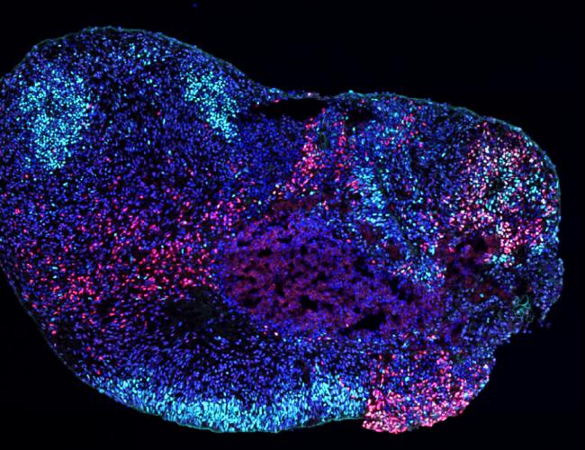 Microscopy image of a human stem cell–derived hippocampal organoid with inhibitory neurons in red