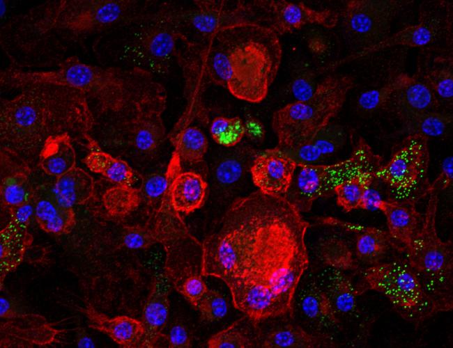 Microscopy image showing senescent macrophages in red and cholesterol-laden lipid droplets – a key driver of senescence – in green. 