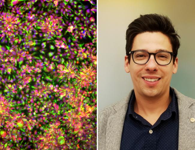 A side-by-side image with a microscopy image showing cell villages on the left and Michael Wells on the right.