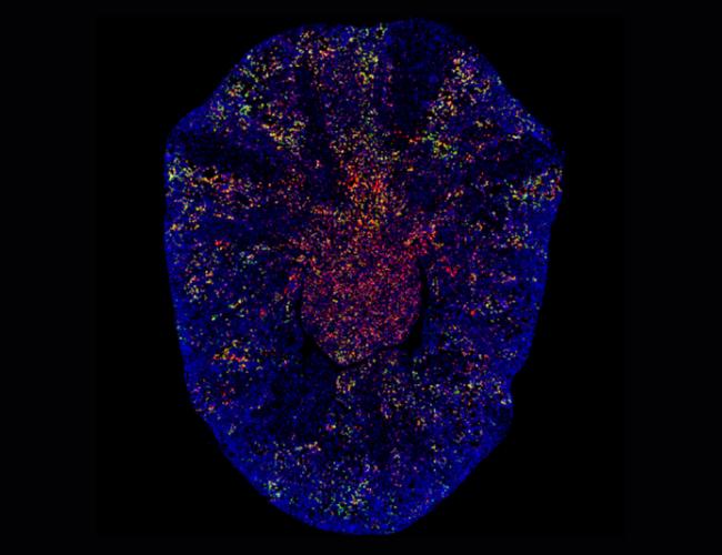 Fluorescent imaging of fibrotic kidney scar tissue