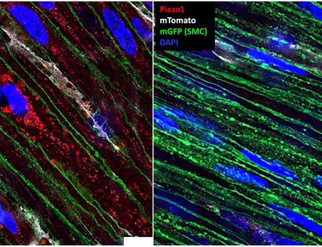Microscopy image of gut muscle cells. 