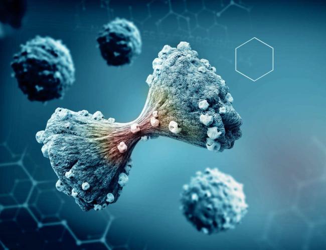 A graphic image of prostate cancer cells.