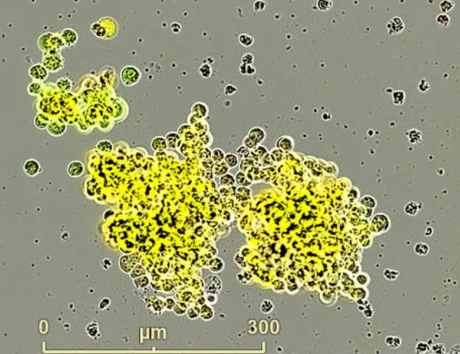 A model of small cell neuroendocrine prostate cancer developed by UCLA scientists.