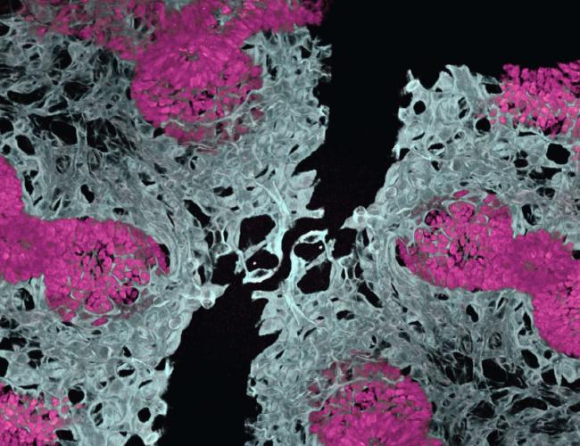 Microscopy image of an embryonic mouse lung showing blood vessels (in white) and air sacs (in pink)