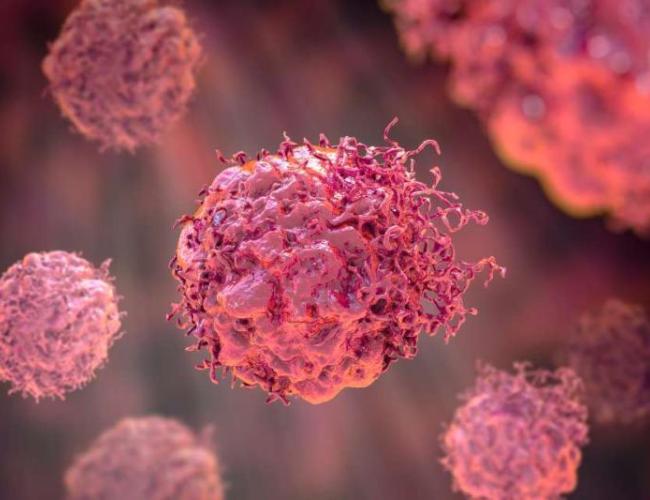 3D illustration of a cancer cell. Credit: Shutterstock