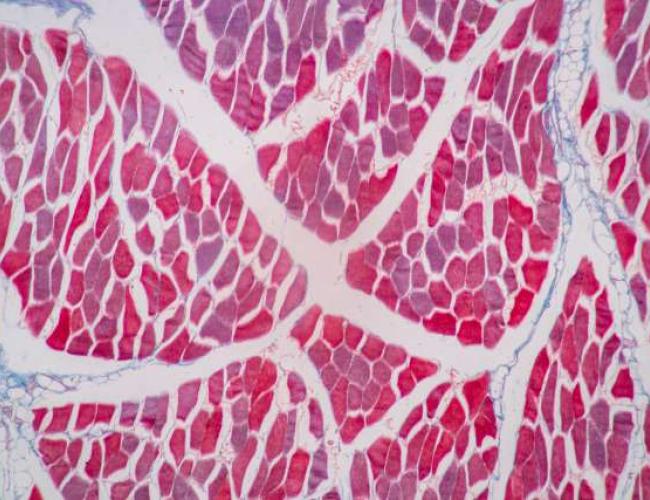 A microscopy image of skeletal muscle tissue stained in shades of pink and red.
