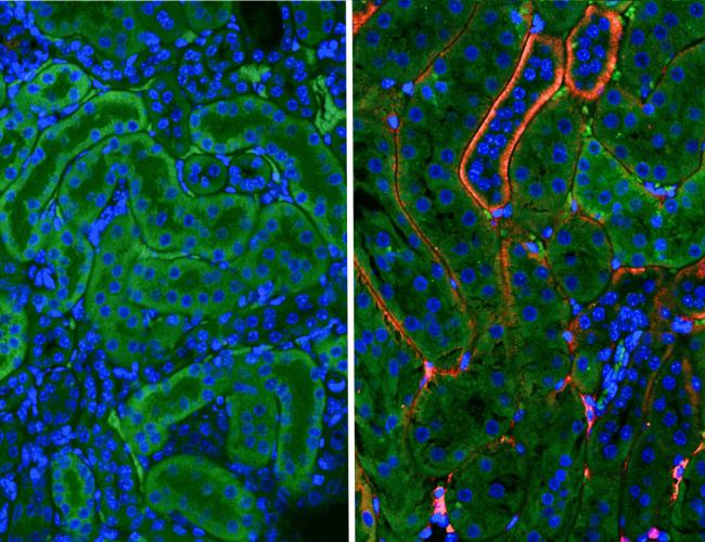 Side-by-side fluorescence microscopy images of injured mouse kidney tissue. The left image, from a mouse treated with the experimental drug AD-NP1, shows bright red fluorescence indicating the antibody has reached its target. The right image, from an untreated mouse, shows no red signal. Blue marks cell nuclei; green is natural tissue coloring.