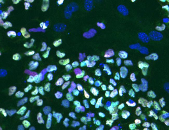 Microscope image of a colony of naive human embryonic stem cells showing the TFAP2C protein (green). The cells’ nuclei are blue.