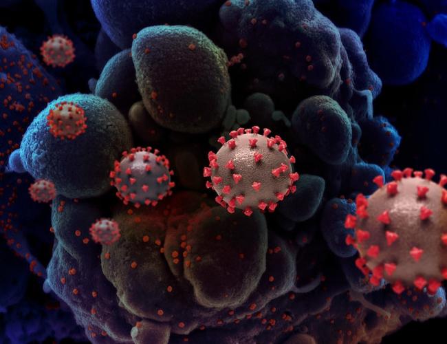 Creative rendition of SARS-COV-2 virus particles 