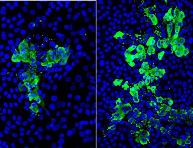 Microscopic images of human stem cell–derived airway tissue models with cell nuclei (blue) and SARS-CoV-2 virus infected cells (green); tissue exposed to cigarette smoke (right) had 2 to 3 times more infected cells than non-exposed tissue (left). 