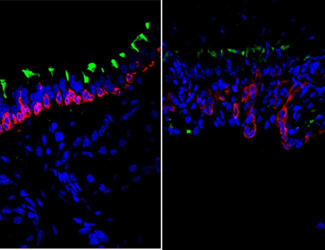 Microscopic image showing stem cells in young (left) and old (right) airways with cell nuclei seen in blue, airway basal stem cells seen in red and ciliated cells seen in green.