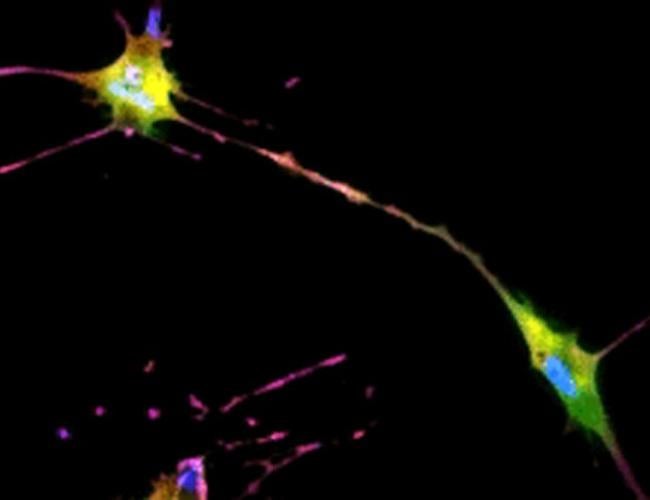 The developed AI algorithm can transform a brightfield image into a fluorescent-like image without sacrificing the cells to obtain.