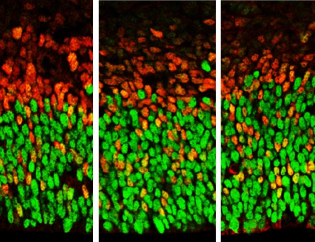Image showing brain cells with lower levels of Foxp1 function (at left) and higher levels (right). Apical radial glia are stained in green and secondary progenitors and neurons stained in red.