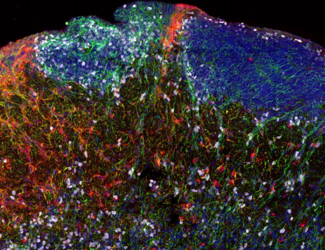 Fluorescent imaging of diverse cell types in a human brain section. 