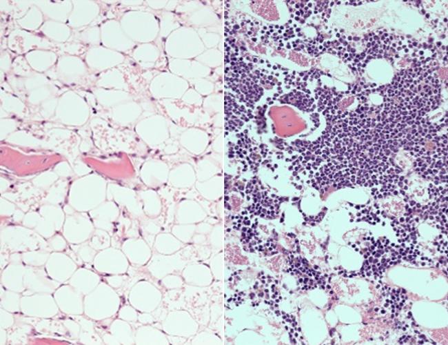 Bone marrow showing a loss of blood cells in mice after radiation (left) and then after treatment with the PTP-sigma inhibitor (right), where the recovery of blood cells is visible.