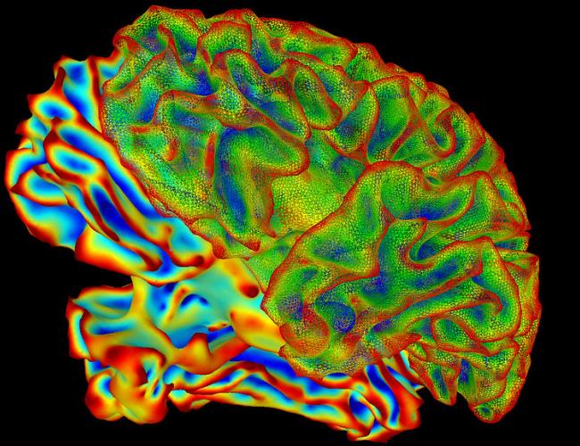 Image of a whole brain created using a computer image processing program called SUMA