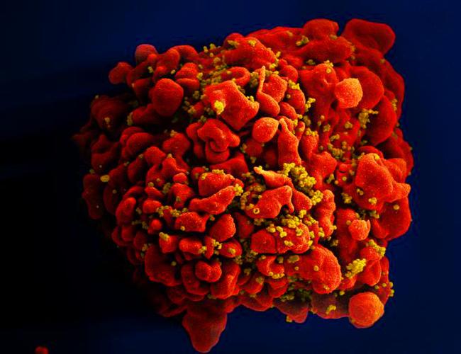 The improved therapy engineers the body’s immune response against HIV rather than waiting for the virus — or parts of the virus — to induce a response. (Image: A T cell infected with HIV.)