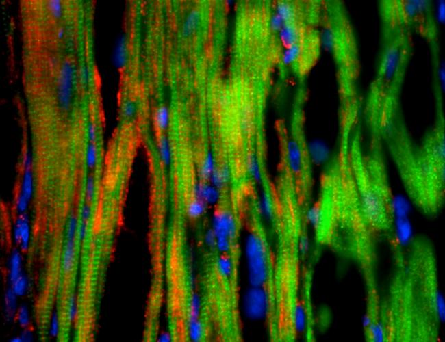 Researchers observed clusters of cardiac muscle cells (in red and green) derived from human embryonic stem cells 40 days after transplantation.