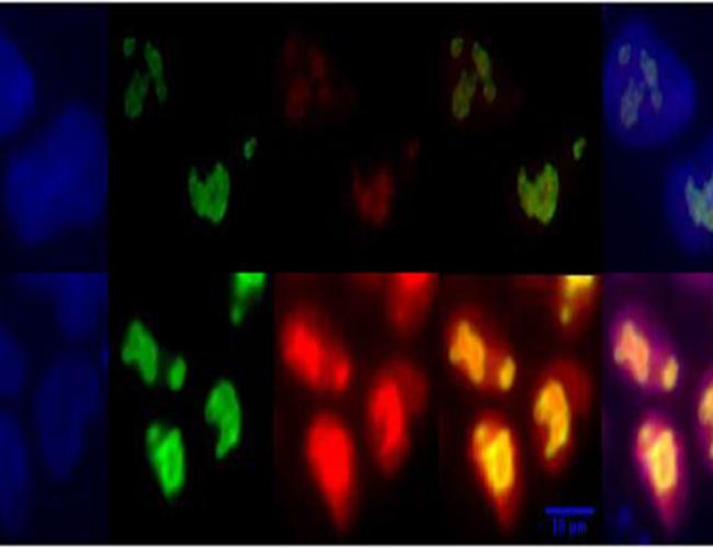 Colorful staining indicates higher levels of a key sugar metabolism regulator in naïve (bottom row) versus primed (top row) human embryonic stem cells.