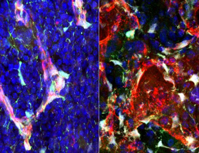 Expression of pleiotrophin (green) in bone marrow blood vessels (red) and stromal cells (white) is shown in normal mice (left) and in mice at 24 hours following irradiation (right).
