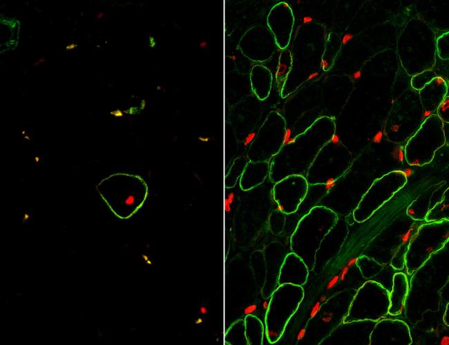Skeletal muscle cells isolated using the ERBB3 and NGFR surface markers (right) restore human dystrophin (green) after transplantation significantly greater than previous methods (left).