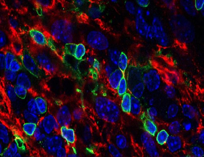 A section of an artificial thymic organoid showing T cells (outlined in green) created from blood stem cells. | UCLA Broad Stem Cell Research Center/Cell Reports
