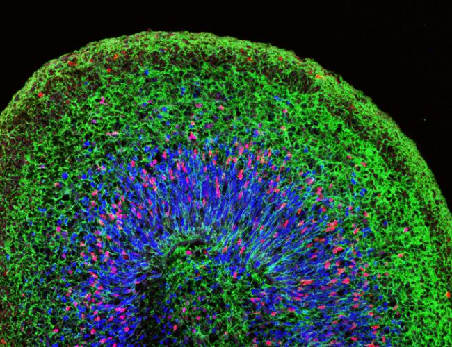 Microscopic image of a mini brain organoid, showing layered neural tissue and different groups of neural stem cells (in blue, red and magenta) giving rise to neurons (green).