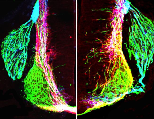 Left: axons (green, pink, blue) form organized patterns in the normal developing mouse spinal cord. Right: removing netrin1 results in highly disorganized axon growth.